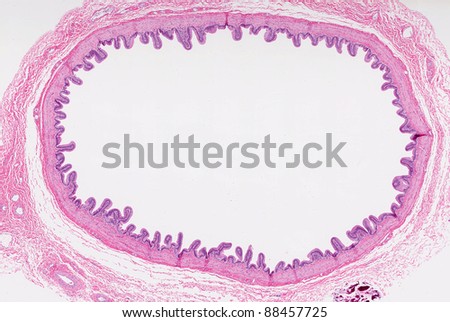 A cross sectional view of normal healthy gallbladder - organ which stores bile secreted by the liver