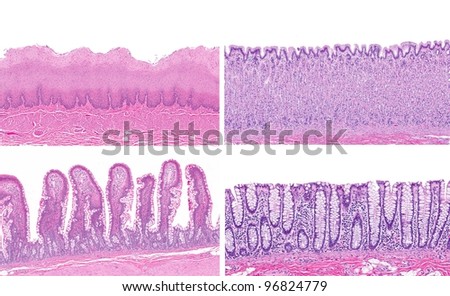 Small Esophagus