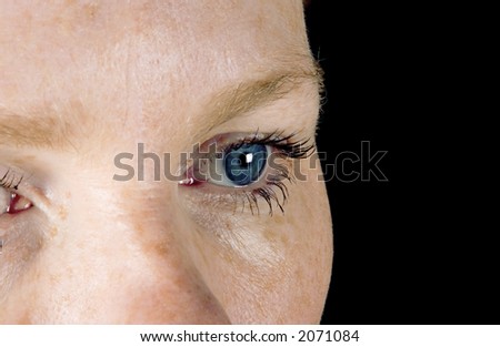 deep blue eye on freckled face