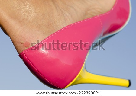 Close up of female foot in pink high heel pumps and  painful looking blister on skin, with blue sky as background and copy space.