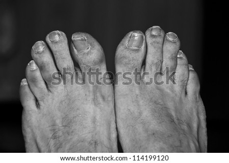 the dirty feet of a poor man