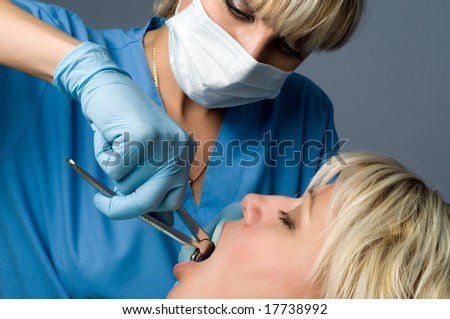 tooth extraction using forceps, special dental instrument for teeth removal