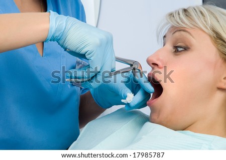 tooth extraction using forceps, scared patient