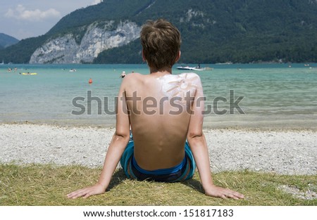 A boy with suntan on his back in the shape of the sun