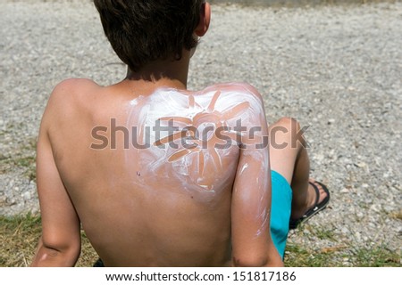 A boy with suntan on his back in the shape of the sun
