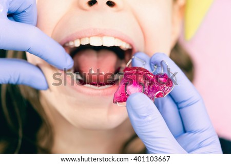 Dentist putting dental braces in little girls mouth