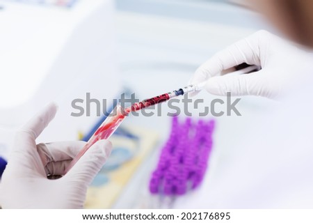Scientist working at the blood laboratory Scientist working at the blood laboratory
