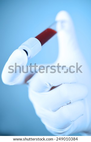Hand holding blood in test tube take with blue filter