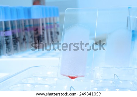 blood testing in laboratory for microscope take with blue filter
