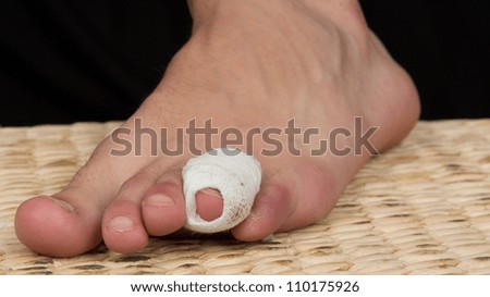 A bandage around a sore toe, on a black background