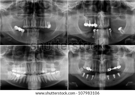 panoramic dental