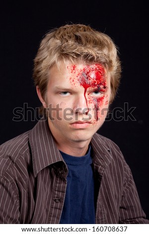 Caucasian teenage boy with blonde hair with serious head injury