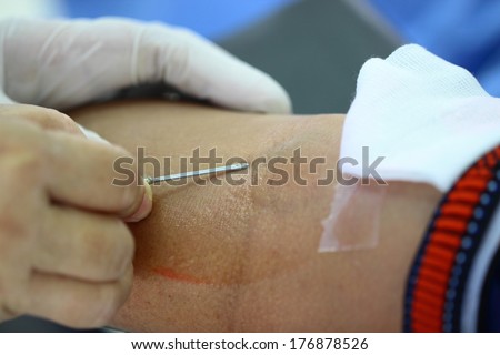 On step about penetrate syringe into vein on blood donation