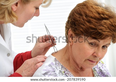 Doctor removing a tick with  tweezers from skin of patient