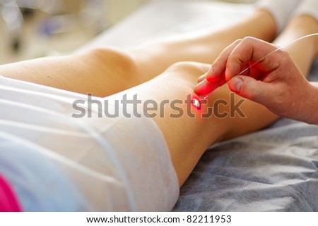 Varicose laser treatment on female legs in clinic Varicose laser treatment on female legs in clinic