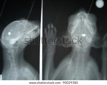 Roentgen picture of shooting injury by dog