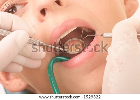woman patient at the dentist -close up