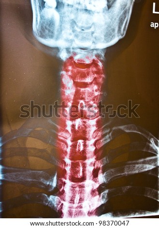 X ray of the human bones