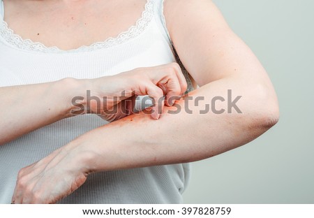 Woman scratching a rash on her arm. Landscape.