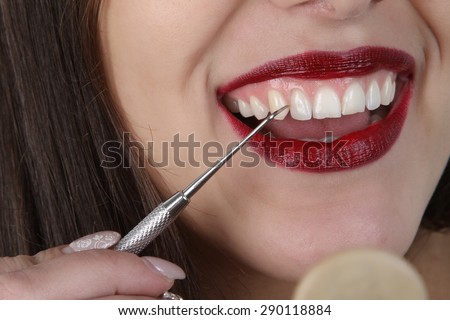 teeth and lips - dental tools - bright red lips with very white teeth beautiful young girl