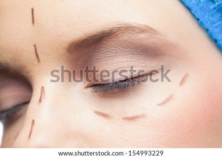 Extreme close up on relaxed patient with dotted lines on the face before surgery