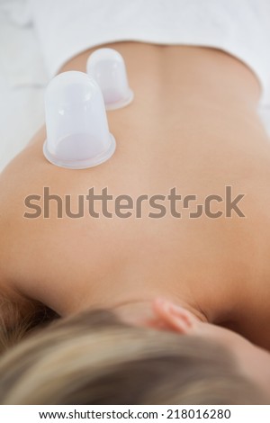Pretty blonde with vacuum cups on her back at the health spa