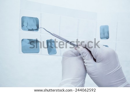 Close up of gloved hand holding dental tool to teeth x-ray