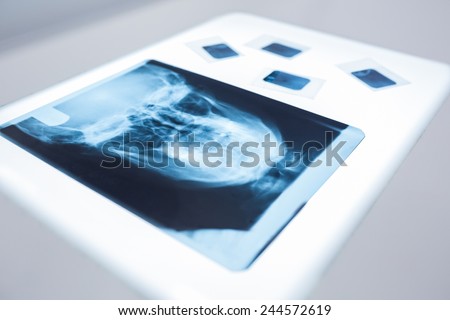 Close up of a x-ray of a human skull on the table at the dental clinic