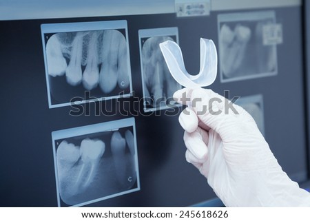 Close up of teeth x-ray
