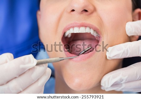 Dentist examining a patient with angle mirror in dental clinic