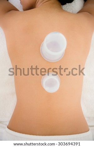 Woman with vacuum cups on her back at the health spa