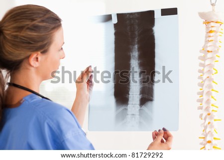 Brunette doctor with a stethoscope and a x-ray in the surgery