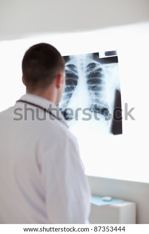 Doctor using light to check x-ray photograph