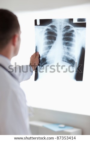 Close up of doctor holding x-ray image against light