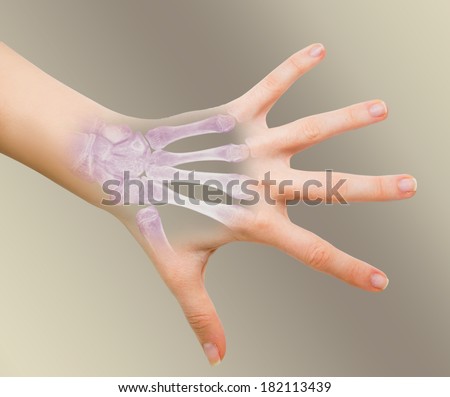 hand pain on x-ray