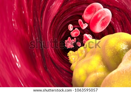 Cholesterol formation, fat, artery, vein, heart. Narrowing of a vein for fat formation. 3d rendering