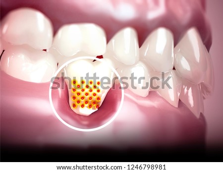 Mouth, teeth, gums. Sensitive teeth, withdrawal of the gingiva. Dental sensitivity. Dental laboratory. 3d rendering