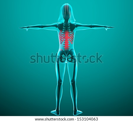 Human x-ray with pain in the spine and ribs