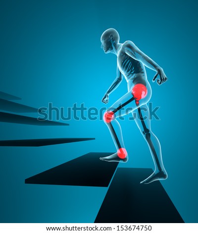 Joint pain man climb the stairs to the x-ray