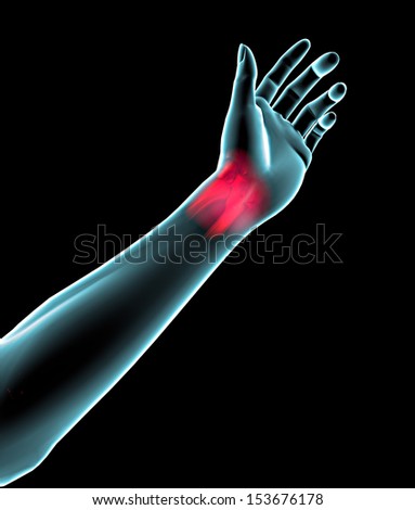 Hand wrist arm pain
