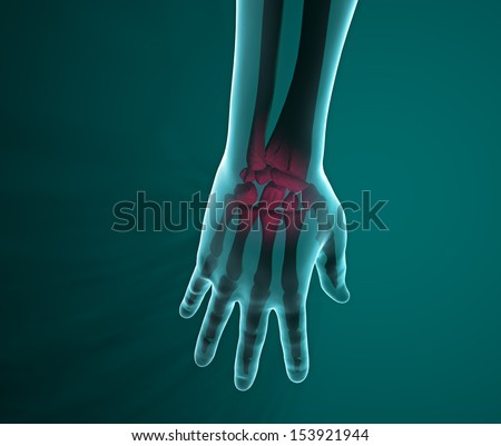 Hand X-ray bone pain wrist