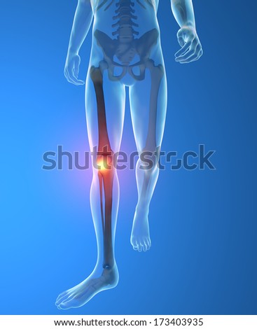 Man, skeleton, walk, knee pain inflammation