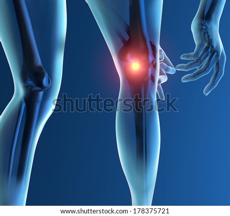 Inflammation pain knee skeleton x-ray