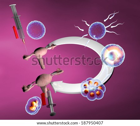 In vitro fertilization, artificial insemination route. Natural cycle in vitro fertilization
