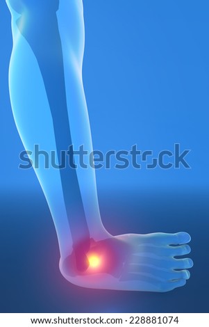 Man running with ankle pain breaking distortion