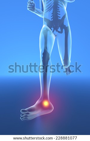 Man running with ankle pain breaking distortion