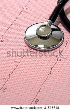 Medical doctor pulse examination stethoscope on heart health evaluation EKG diagnosis graph test electrocardiogram report at a health care provider facility