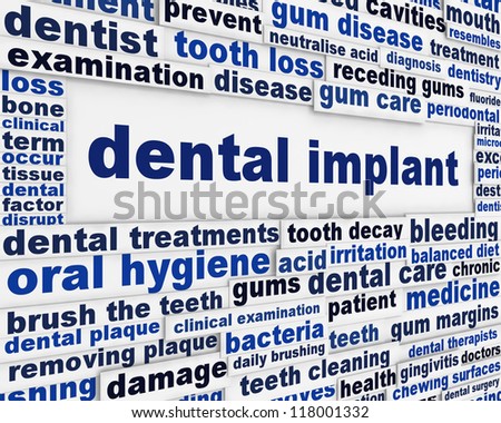 Dental implant medical message background. Dental surgery poster design