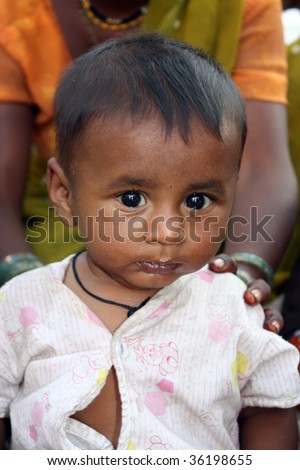 A cute baby sick due to living conditions in poor parts of India.