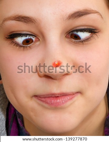 Young girl with pimple of her nose